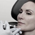 Lifted By Lindsay:  Lower Face Hyaluronic Acid Filler Injections